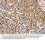 SLC2A2 Antibody