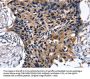 SLC2A2 Antibody