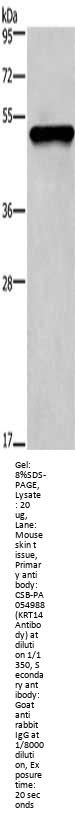 KRT14 Antibody