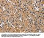 CEACAM3 Antibody