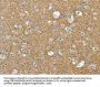 VAMP2 Antibody