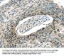 VAMP2 Antibody
