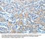 BAG3 Antibody