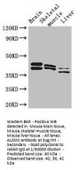 ALDOC Antibody