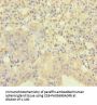 AGRP Antibody