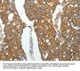 ROCK1 Antibody