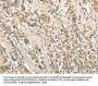ROCK1 Antibody