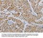 PPARGC1B Antibody