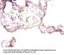 ANGPT1 Antibody