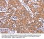 TNFRSF17 Antibody