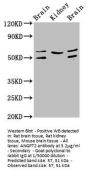 ANGPT2 Antibody