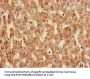 ANGPTL3 Antibody
