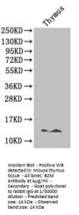 Rabbit anti-human Beta-2-microglobulin polyclonal Antibody