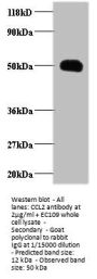 CCL2 Antibody
