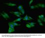 CCL2 Antibody