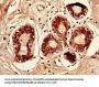 CCL2 Antibody