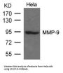 MMP9 Antibody