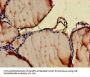 CCL3 Antibody