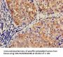 CCL3 Antibody