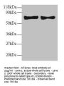 CCL5 Antibody