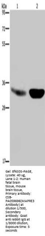 Rabbit anti-human MAPRE3 polyclonal antibody