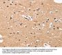 HDAC8 Antibody