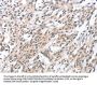 HDAC8 Antibody