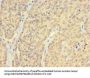 AR Antibody