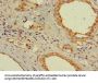 AR Antibody
