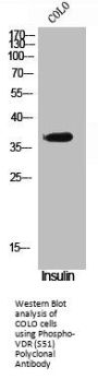 Phospho-VDR (S51) Antibody