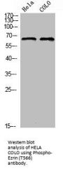 Phospho-EZR (T566) Antibody