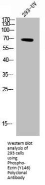 Phospho-EZR (Y146) Antibody
