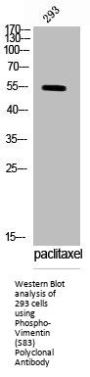 Phospho-VIM (S83) Antibody