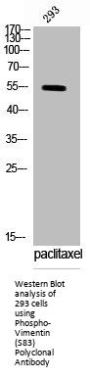 Phospho-VIM (S83) Antibody