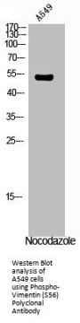 Phospho-VIM (S56) Antibody