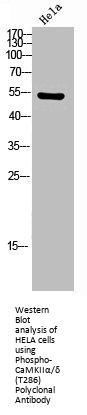 Phospho-CAMK2A/CAMK2D (T286) Antibody