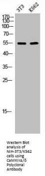 CAMK2A/CAMK2D Antibody