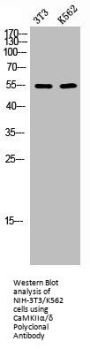 CAMK2A/CAMK2D Antibody