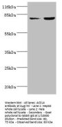 ACSL4 Antibody