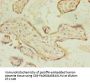 ACSL4 Antibody