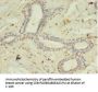 ACSL4 Antibody