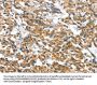 CASQ2 Antibody