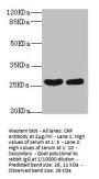 CRP Antibody
