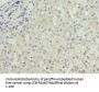 CRP Antibody