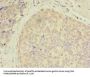 CXCL6 Antibody