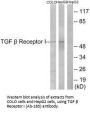 TGFBR1 (Ab-165) Antibody