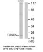 TUSC5 Antibody