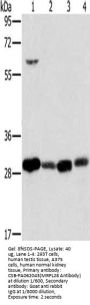 MRPL28 Antibody