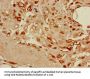 DKK1 Antibody