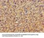 DKK1 Antibody